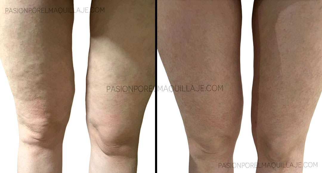 Glo 910 PRO: antes y después Antes y después de mis piernas con Glo 910